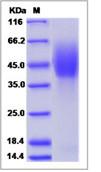 SDS-PAGE - Recombinant Human Niemann Pick C1 protein (His tag) (AB276725), expandable thumbnail