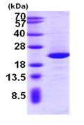 SDS-PAGE - Recombinant Human NIP7 protein (AB95504), expandable thumbnail
