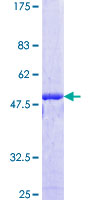 Recombinant Human NIPBL protein