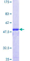 SDS-PAGE - Recombinant Human NIPBL protein (AB131913)