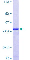 SDS-PAGE - Recombinant Human NIPBL protein (GST tag N-Terminus) (AB131913)