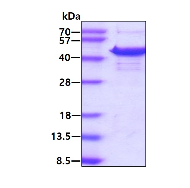 SDS-PAGE - Recombinant Human NIPP1 protein (His tag C-Terminus) (AB131705)