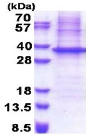 SDS-PAGE - Recombinant Human NIPSNAP1 protein (denatured) (His tag N-Terminus) (AB174557)