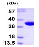 SDS-PAGE - Recombinant Human NIT2 protein (His tag N-Terminus) (AB102690)