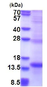 SDS-PAGE - Recombinant Human NK-p44 protein (denatured) (His tag N-Terminus) (AB177598)