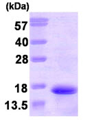 SDS-PAGE - Recombinant Human NKB protein (AB87669)