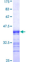 Recombinant Human NKF3 kinase family member/PEAK1 protein