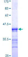 SDS-PAGE - Recombinant Human NKF3 kinase family member/PEAK1 protein (GST tag N-Terminus) (AB164128)