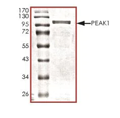 SDS-PAGE - Recombinant Human NKF3 kinase family member/PEAK1 protein (Tagged) (AB268846)