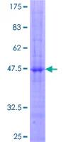 SDS-PAGE - Recombinant Human NKG2A protein (AB158798)