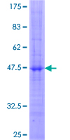 SDS-PAGE - Recombinant Human NKG2A protein (GST tag N-Terminus) (AB158798)