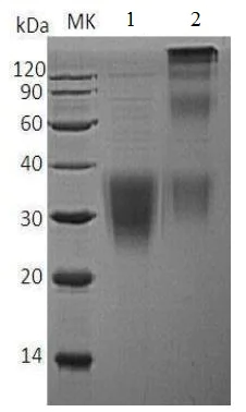 SDS-PAGE - Recombinant Human NKG2A protein (His tag) (AB215651)