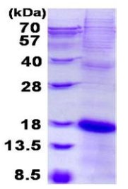 SDS-PAGE - Recombinant Human NKG2C protein (denatured) (His tag N-Terminus) (AB131674)