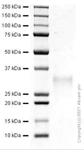 SDS-PAGE - Recombinant Human NKG2D protein (AB281815)