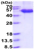 SDS-PAGE - Recombinant human NKG2D protein (Fc tag C-Terminus + His tag C-Terminus) (AB227395)