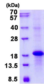 SDS-PAGE - Recombinant Human NKG2E protein (denatured) (His tag N-Terminus) (AB134612)