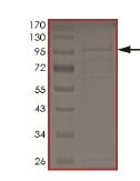 SDS-PAGE - Recombinant Human NKIAMRE protein (AB172189), expandable thumbnail