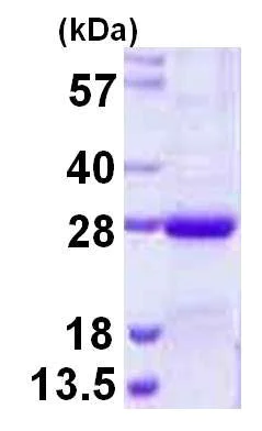 SDS-PAGE - Recombinant Human NKIRAS2 protein (His tag N-Terminus) (AB124599)