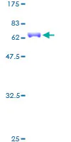 SDS-PAGE - Recombinant Human Nkx2.5 protein (GST tag N-Terminus) (AB152305)
