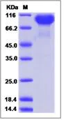 SDS-PAGE - Recombinant Human NLGN4X protein (His tag) (AB276677)