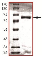 Recombinant human NLK protein