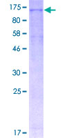 Recombinant Human NLRP3 protein