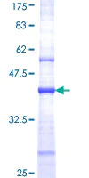 SDS-PAGE - Recombinant Human NMDAR2B protein (AB112298)