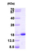 SDS-PAGE - Recombinant Human NME2 protein (AB93692), expandable thumbnail