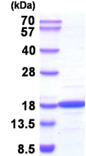 SDS-PAGE - Recombinant human NME2 protein (Tag Free) (AB211313)