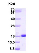 SDS-PAGE - Recombinant Human NME2 protein (Tag Free) (AB93692)