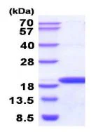 SDS-PAGE - Recombinant human NME3 protein (His tag N-Terminus) (AB211318)
