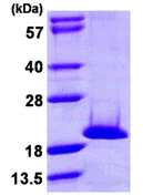 SDS-PAGE - Recombinant Human NME4 protein (His tag N-Terminus) (AB107133)