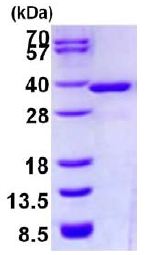 SDS-PAGE - Recombinant Human NMRAL1 protein (AB128450)