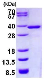 SDS-PAGE - Recombinant Human NMRAL1 protein (His tag N-Terminus) (AB128450)