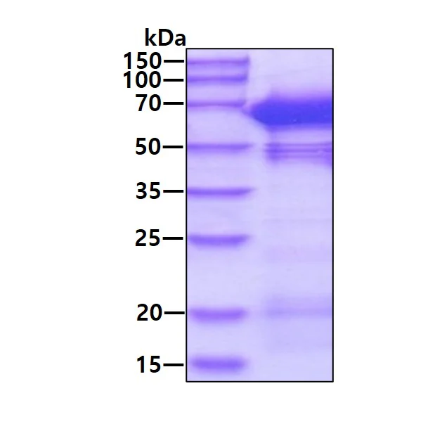 SDS-PAGE - Recombinant Human NMT1/NMT protein (AB202220)