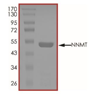 SDS-PAGE - Recombinant human NNMT protein (Active) (AB268816), expandable thumbnail
