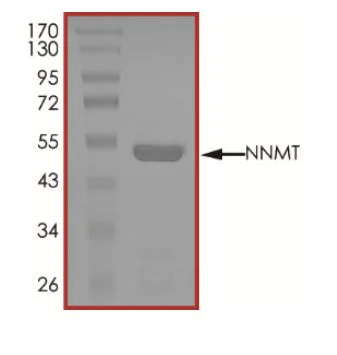 SDS-PAGE - Recombinant human NNMT protein (Active) (AB268816)