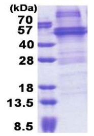 SDS-PAGE - Recombinant Human NOB1 protein (denatured) (AB171677)