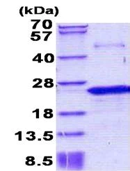 SDS-PAGE - Recombinant Human Nociceptin protein (denatured) (AB156732)