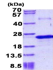 SDS-PAGE - Recombinant Human Nociceptin protein (denatured) (His tag N-Terminus) (AB156732)