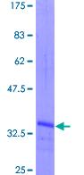 Recombinant Human Nodal protein