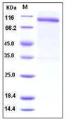 SDS-PAGE - Recombinant Human Nogo Receptor protein (Fc Chimera His Tag) (AB276273)