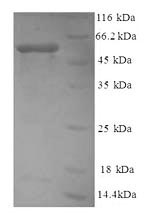 SDS-PAGE - Recombinant Human non-muscle Myosin IIA protein (Tagged) (AB226278)