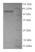 SDS-PAGE - Recombinant Human non-muscle Myosin IIA protein (Tagged) (AB226278)
