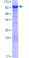 Recombinant Human Norbin protein