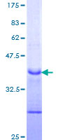 SDS-PAGE - Recombinant Human Notch1 protein (AB114178), expandable thumbnail