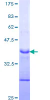 SDS-PAGE - Recombinant Human Notch1 protein (GST tag N-Terminus) (AB114178)