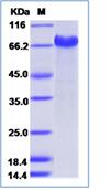 SDS-PAGE - Recombinant Human Notch2 protein (His tag) (AB276341), expandable thumbnail