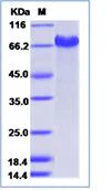 SDS-PAGE - Recombinant Human Notch2 protein (His tag) (AB276341)