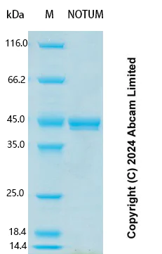 SDS-PAGE - Recombinant Human NOTUM Protein Standard (His tag) (AB323039)